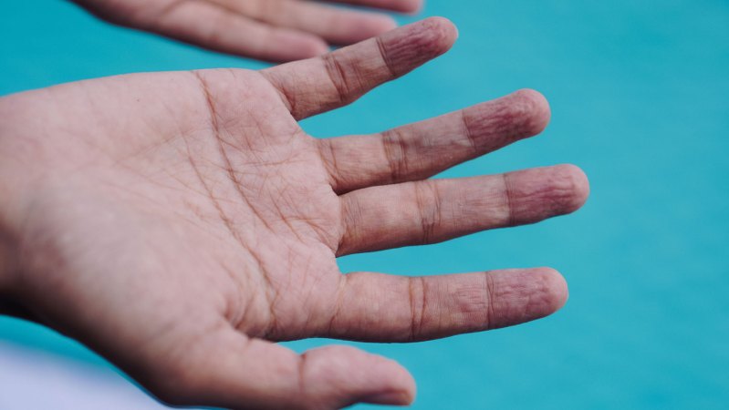 Wet fingers always wrinkle in the same way