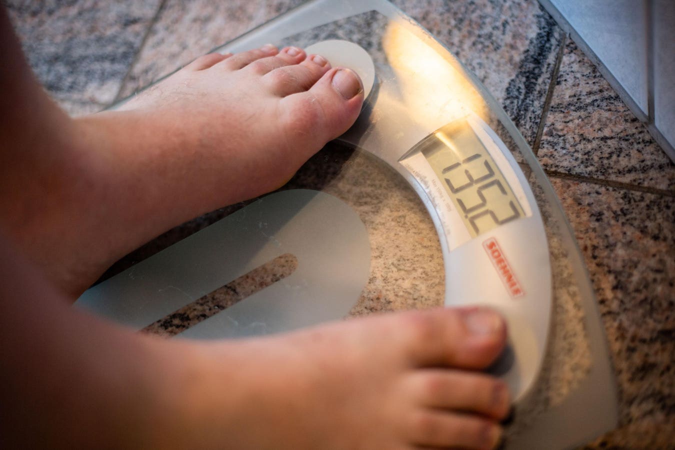 Having ADHD And Living In A Smaller City Might Increase Obesity Risk: Study
