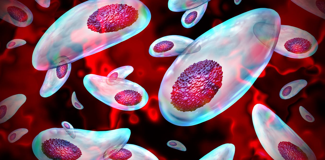 A common parasite can decapitate human sperm − with implications for male fertility