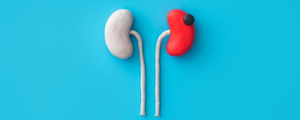 My Kidney Cancer Taught Me That Patients Aren’t Consumers