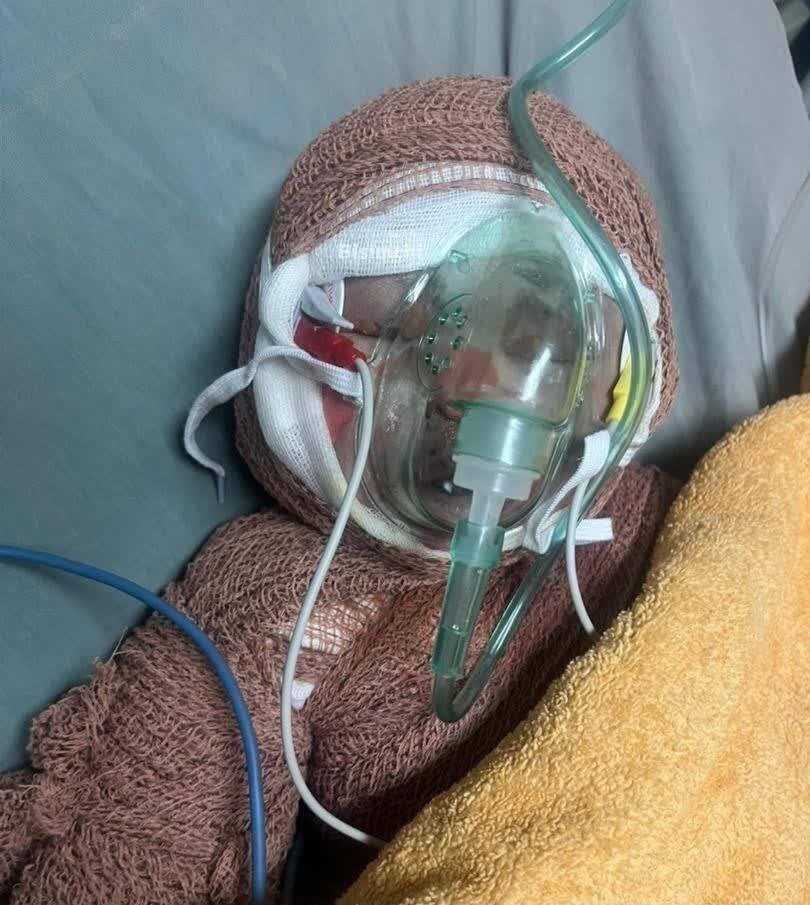 Two-month-old infant, victim of Israel's heinous attacks