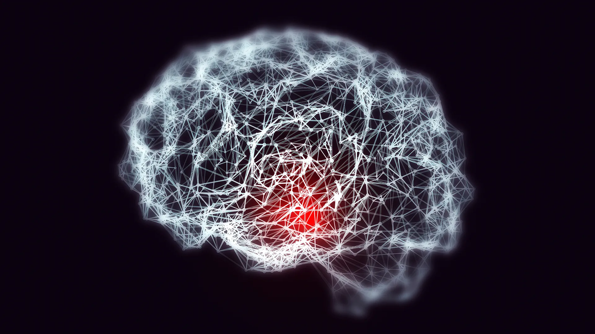 Iron overload: The hidden culprit behind early Alzheimer’s in Down syndrome