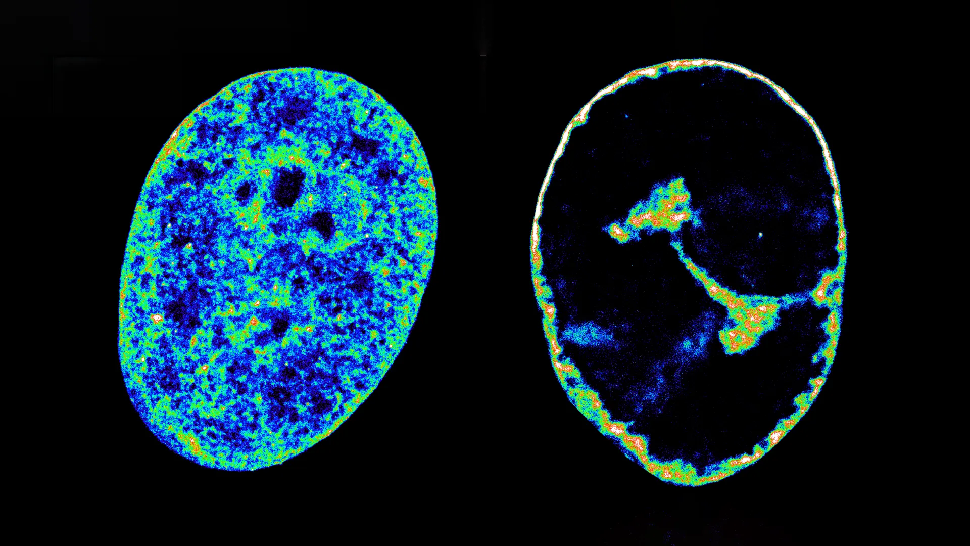Cold sore virus hijacks human genome in 3D–and scientists found its weak spot
