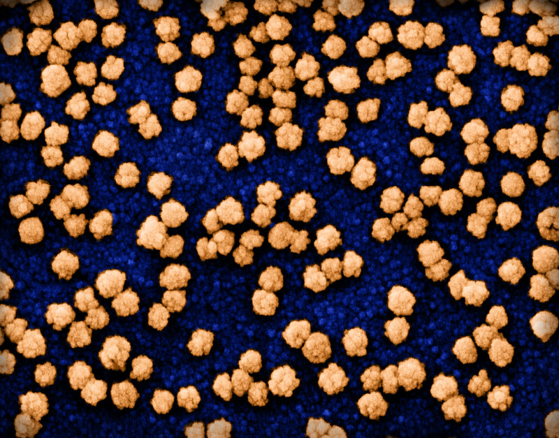 SARS-CoV-2 Can Reprogram Cells to Suppress Immunity