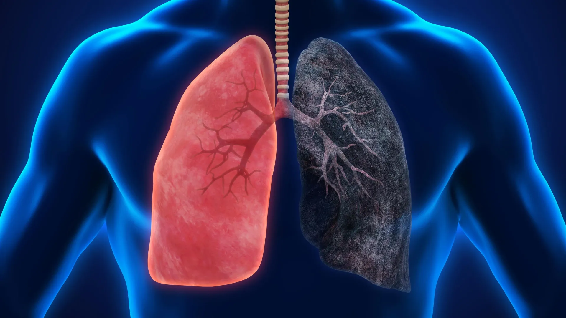 Fire smoke exposure leaves toxic metals and lasting immune changes