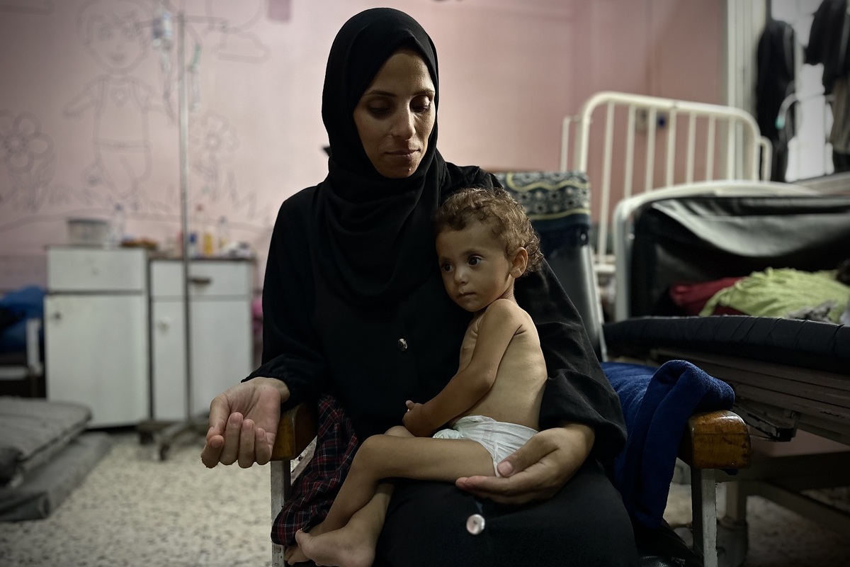 Fourteen-month-old Hazar Arfa, receiving treatment at Nasser Hospital in Khan Yunis in southern Gaza, is in critical condition due to severe malnutrition, as Israel's closure of border crossings and strict blockade severely restrict the entry of food and medicine into the enclave, deepening a hunger crisis that has devastating effects especially on children and infants, on August 15, 2025. [Doaa Albaz - Anadolu Agency]
