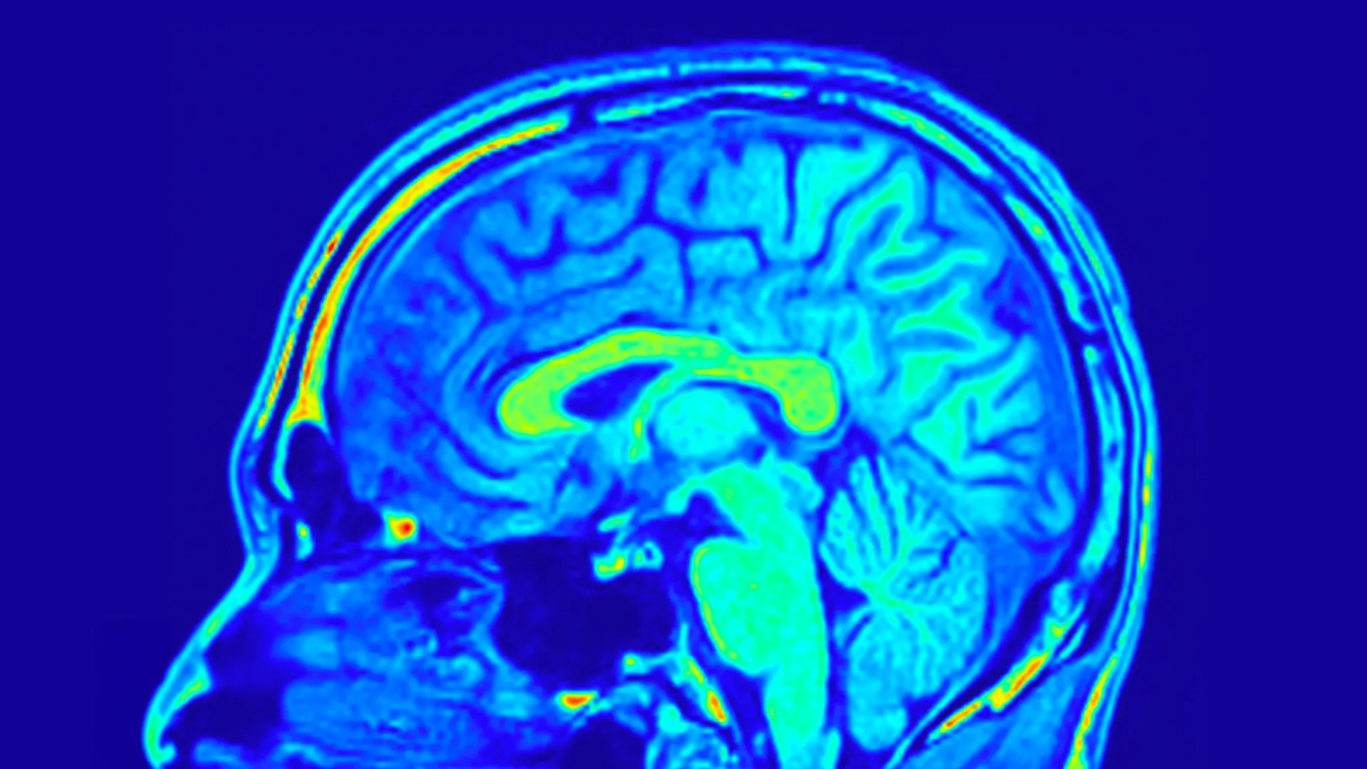 Scientists discover brain layers that get stronger with age