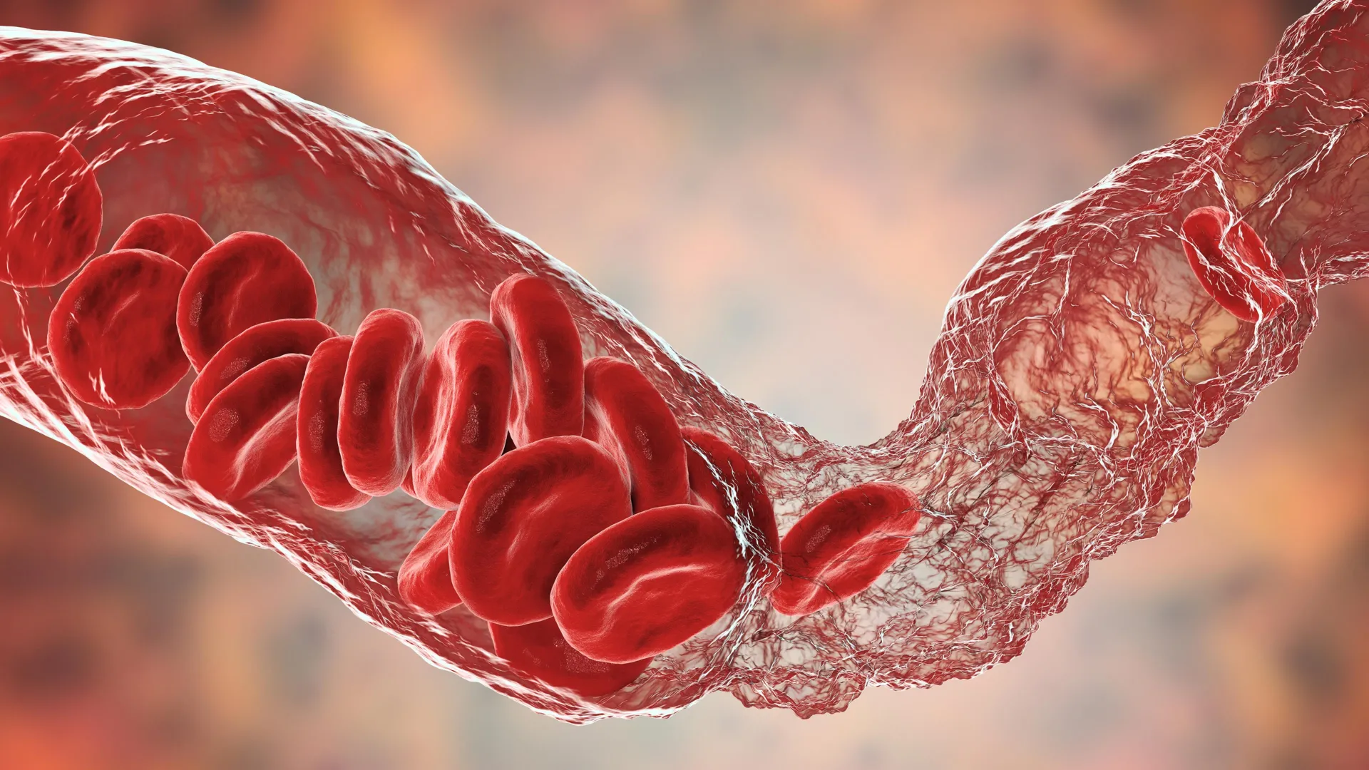Even mild Covid may leave blood vessels five years older