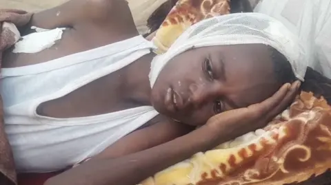 BBC Ahmed Abdul Rahman is lying on a blanket, wearing a vest with bandages on his body