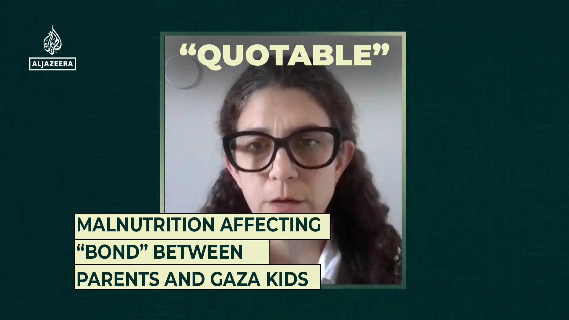 Malnutrition affecting “bond” between parents and Gaza kids | Gaza