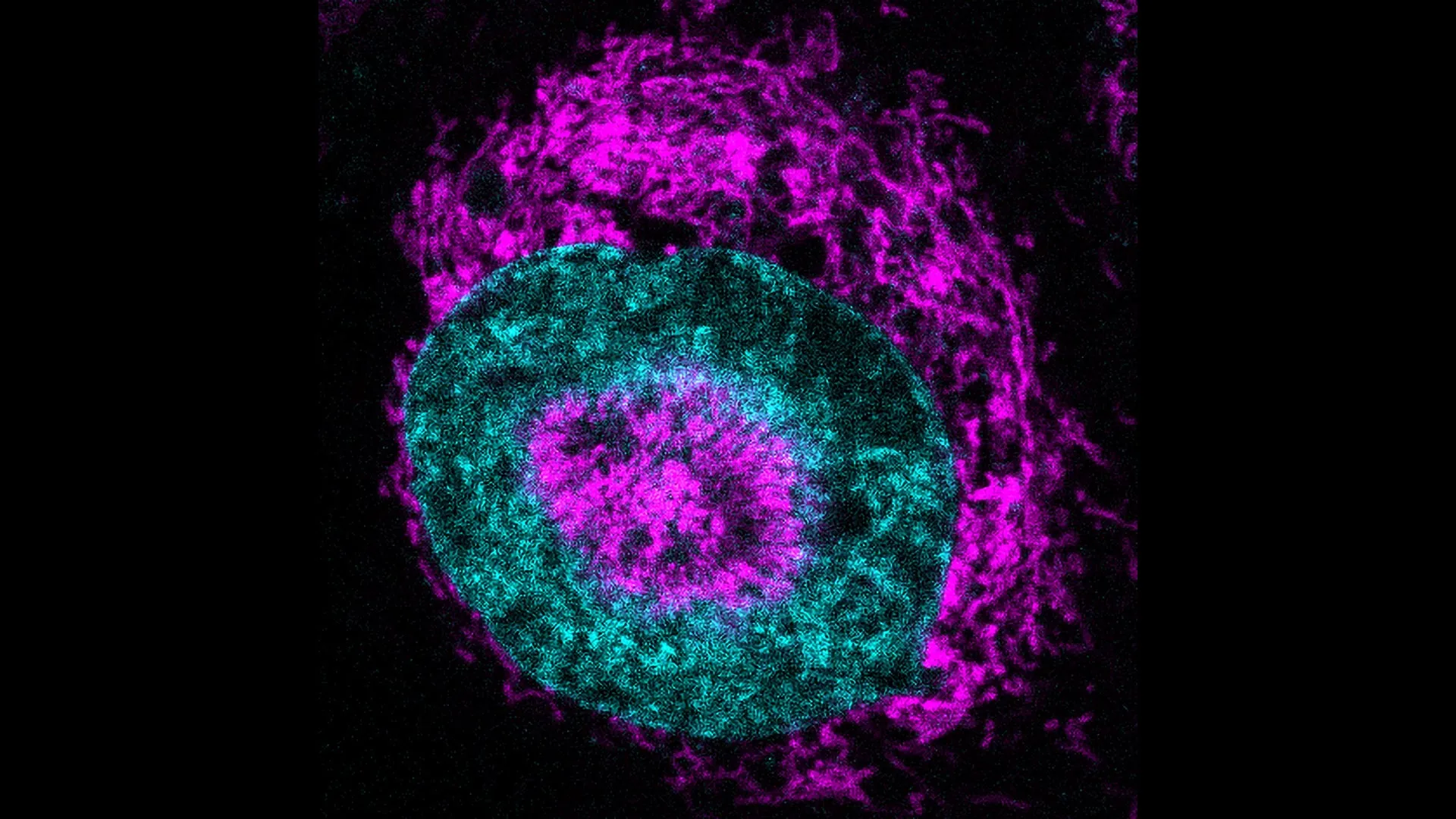 Scientists just found cancer cells’ hidden power source