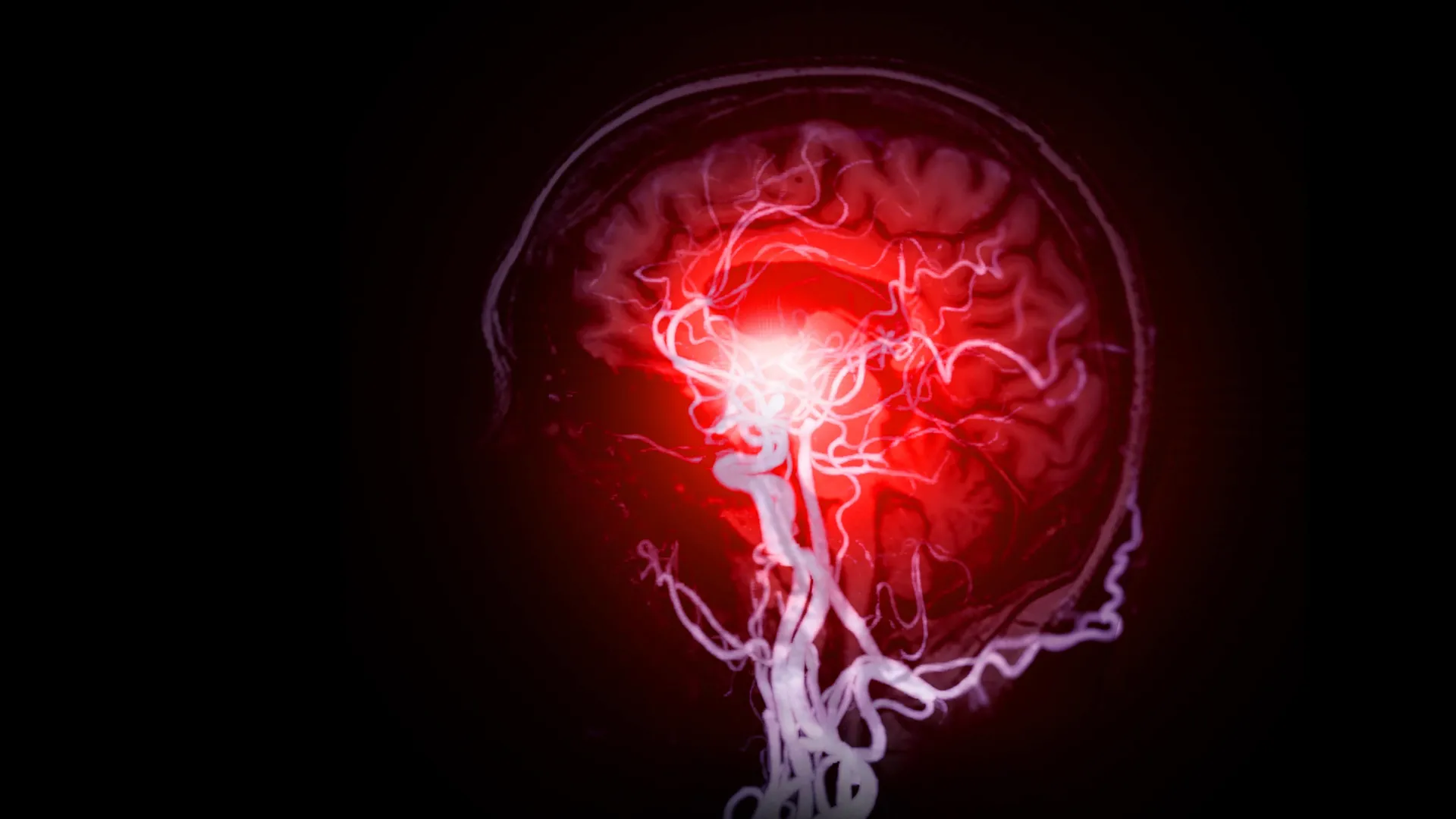 Scientists find hidden brain damage behind dementia