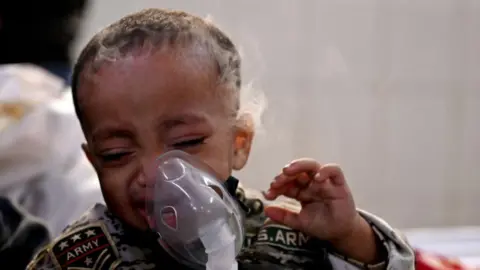 AFP via Getty Images In this picture taken in 2023, a boy with breathing difficulties breathes with the help of a nebuliser at the emergency ward of a government-run children hospital in New Delhi.