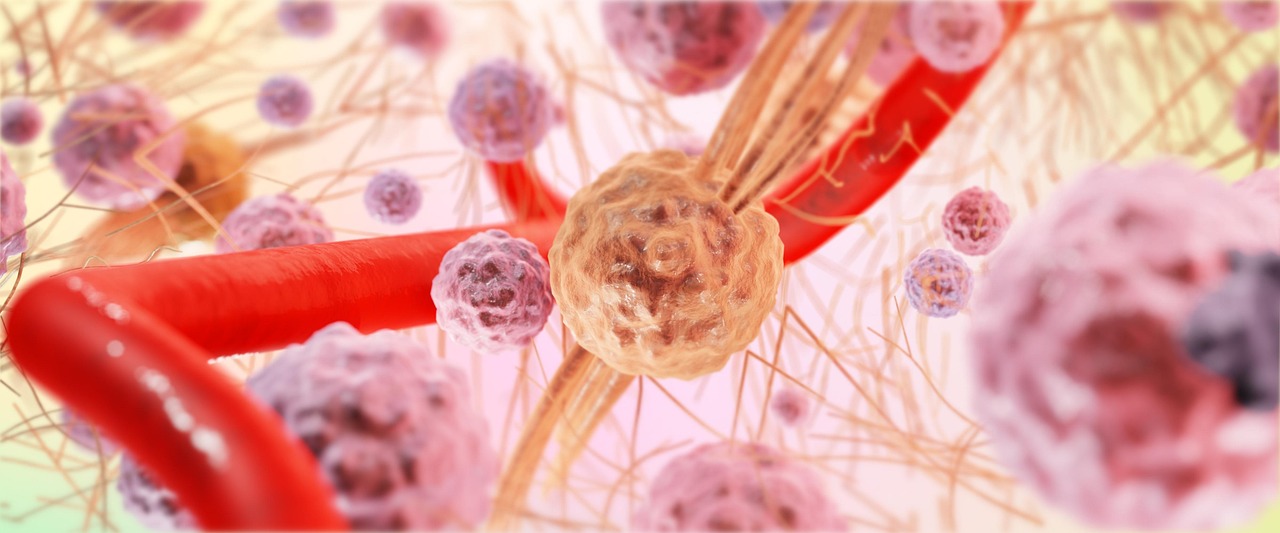 Engineered Immune Cells Improves Anti-Cancer Response