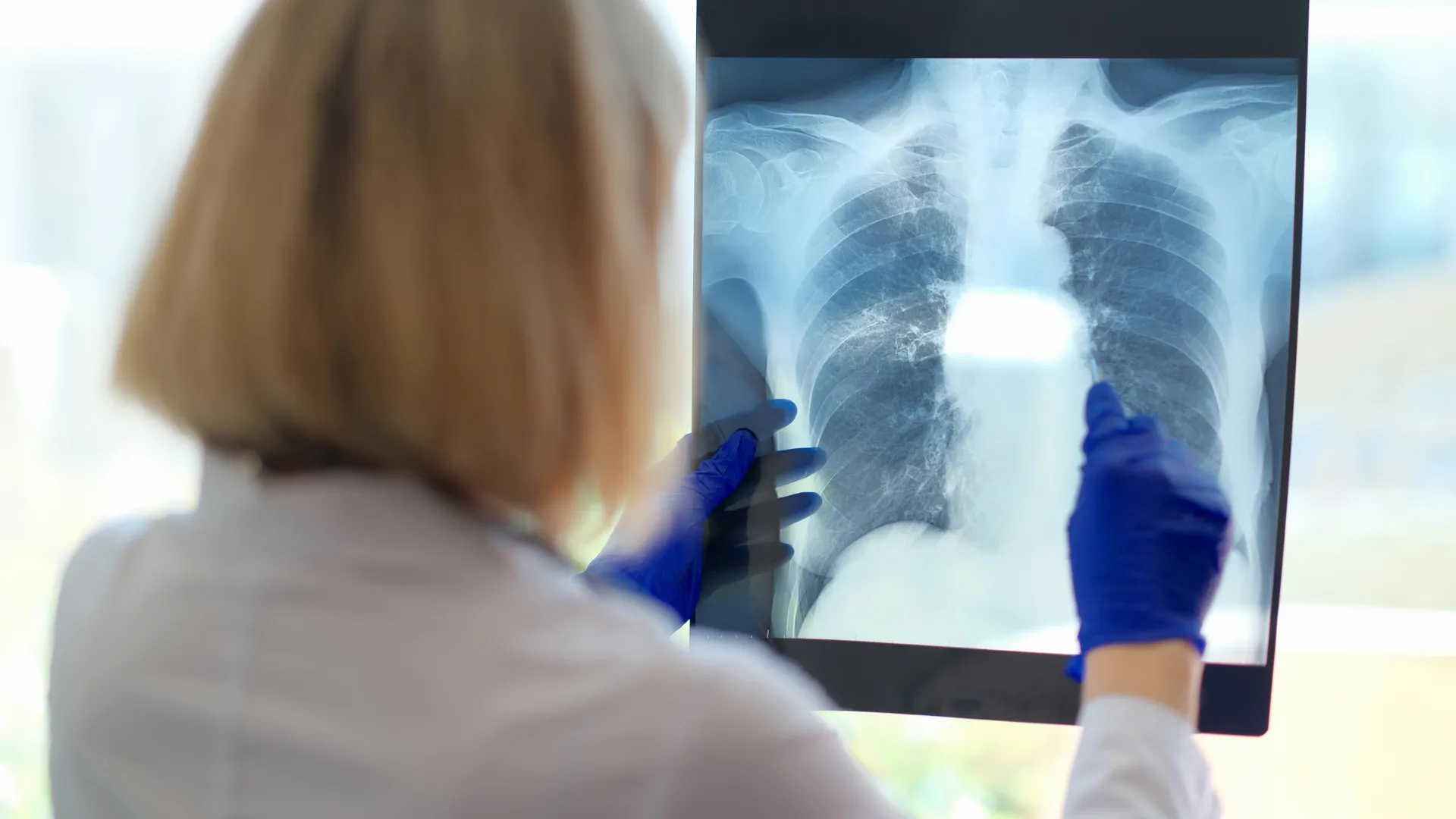 A hidden breathing problem may be behind chronic fatigue’s crushing exhaustion