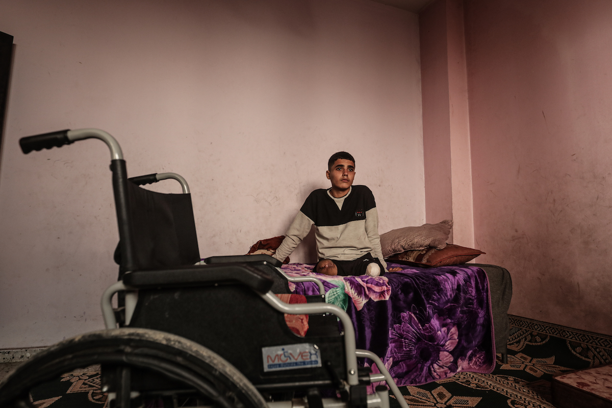 Gaza teen amputee bears scars of Israeli genocide as besieged enclave leads world in child amputations – Middle East Monitor