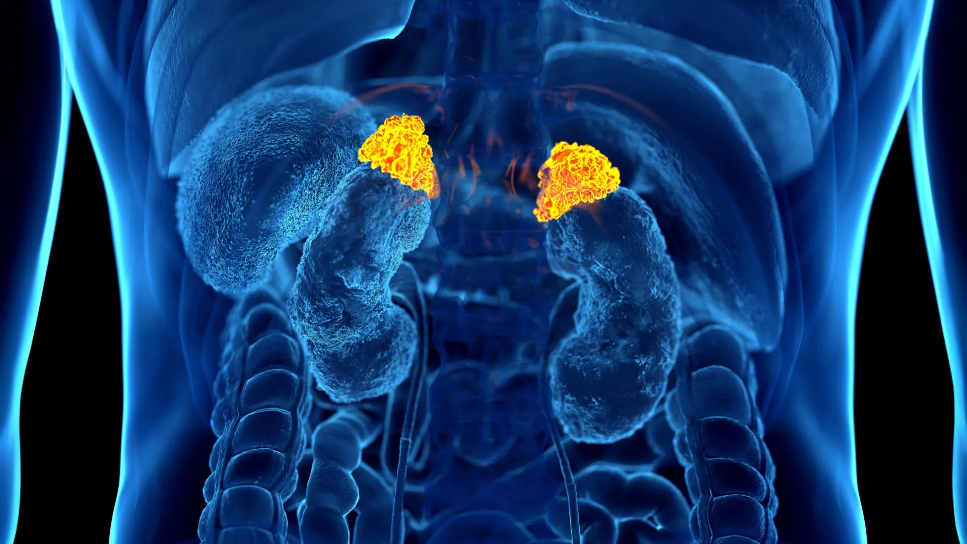 AI finds a hidden stress signal inside routine CT scans