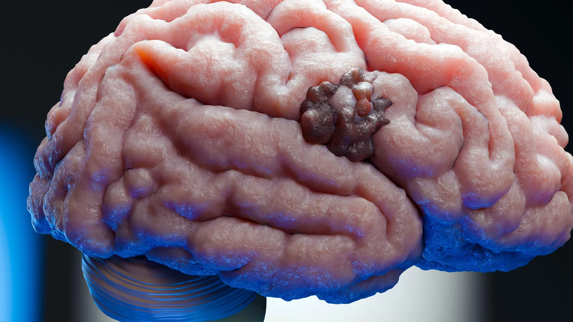 A 70-year-old pregnancy drug just revealed a hidden weakness in brain cancer