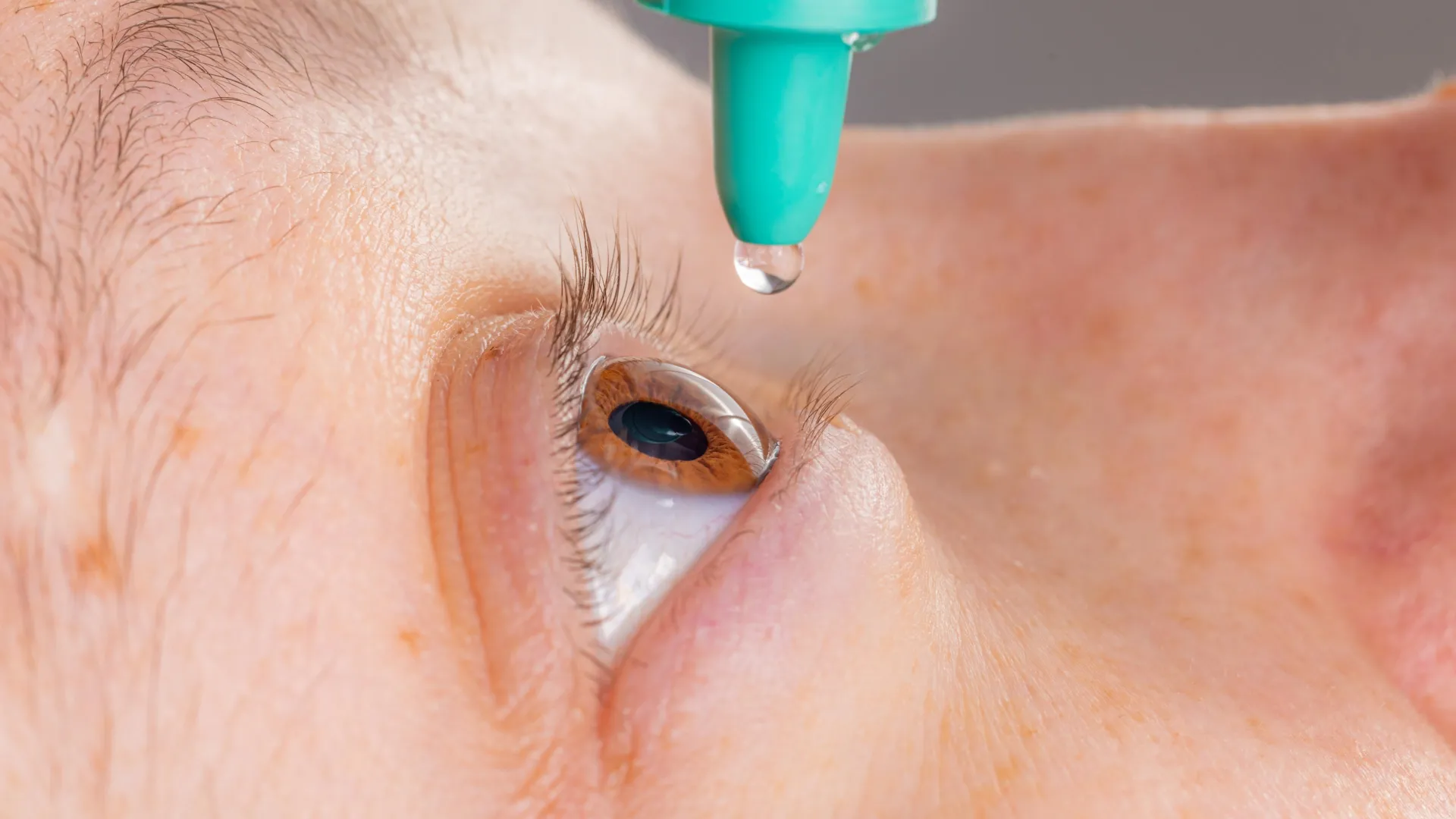 A routine eye treatment is raising new concerns for glaucoma patients