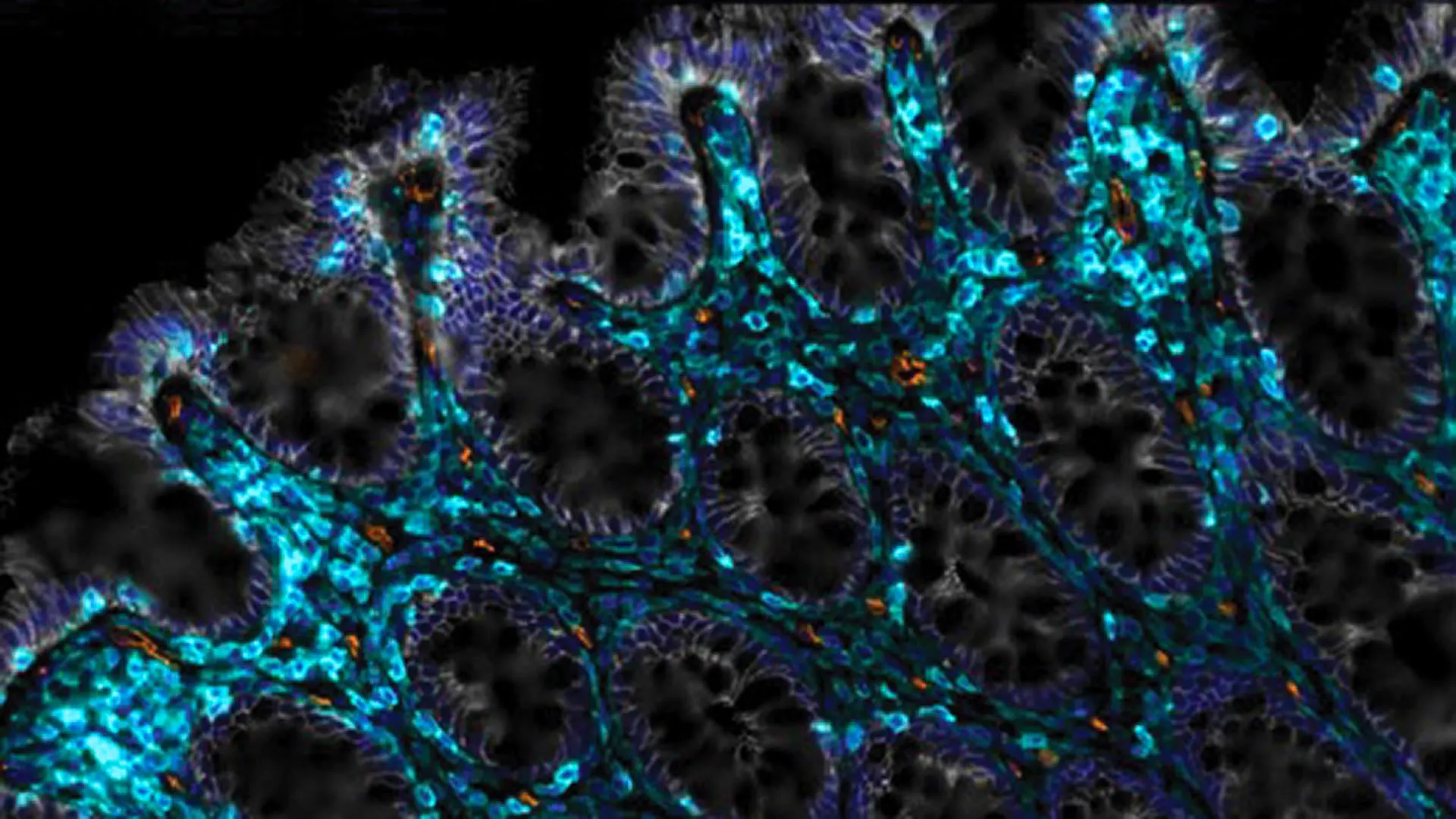 Scientists found a way to help aging guts heal themselves