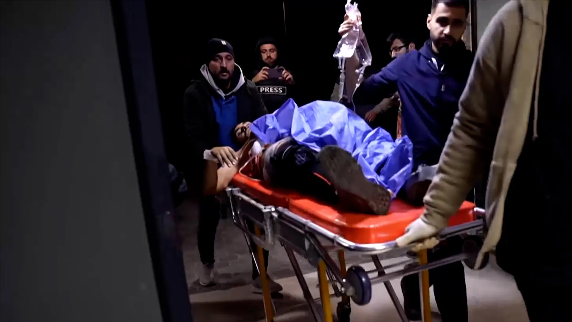 Injured arrive at Aleppo hospital amid intense artillery fire | Syria’s War