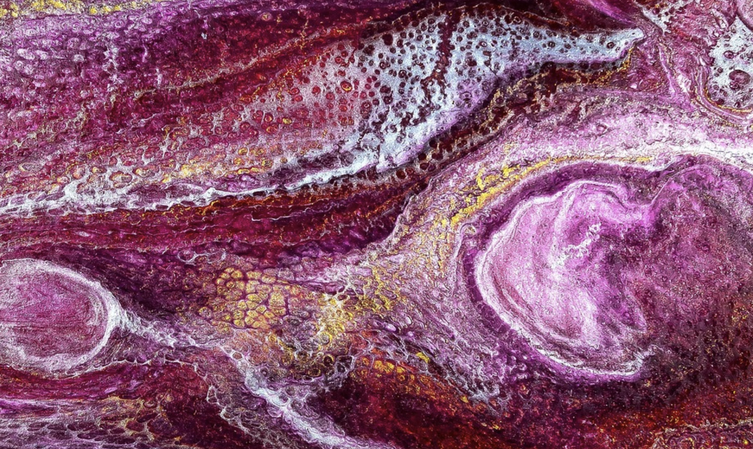 Gut Microbes Make a Metabolite That Increases Inflammation