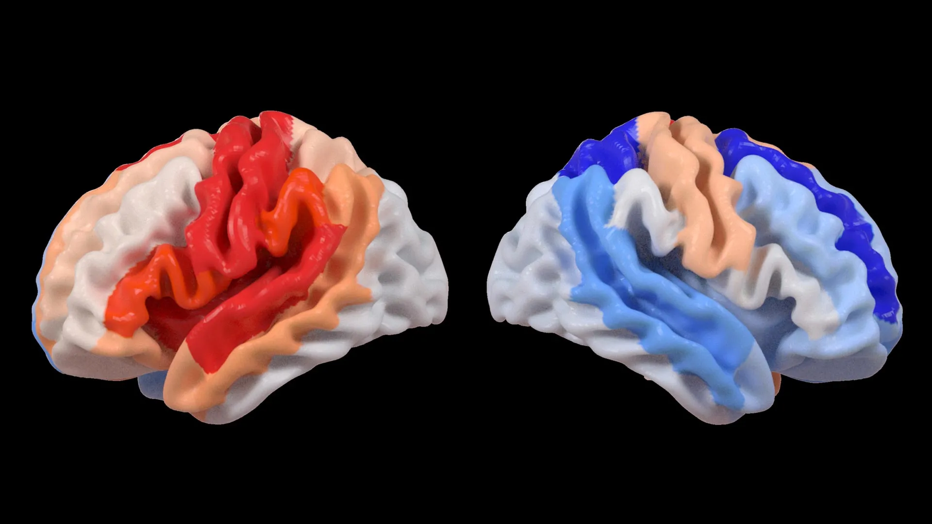 Stroke triggers a hidden brain change that looks like rejuvenation