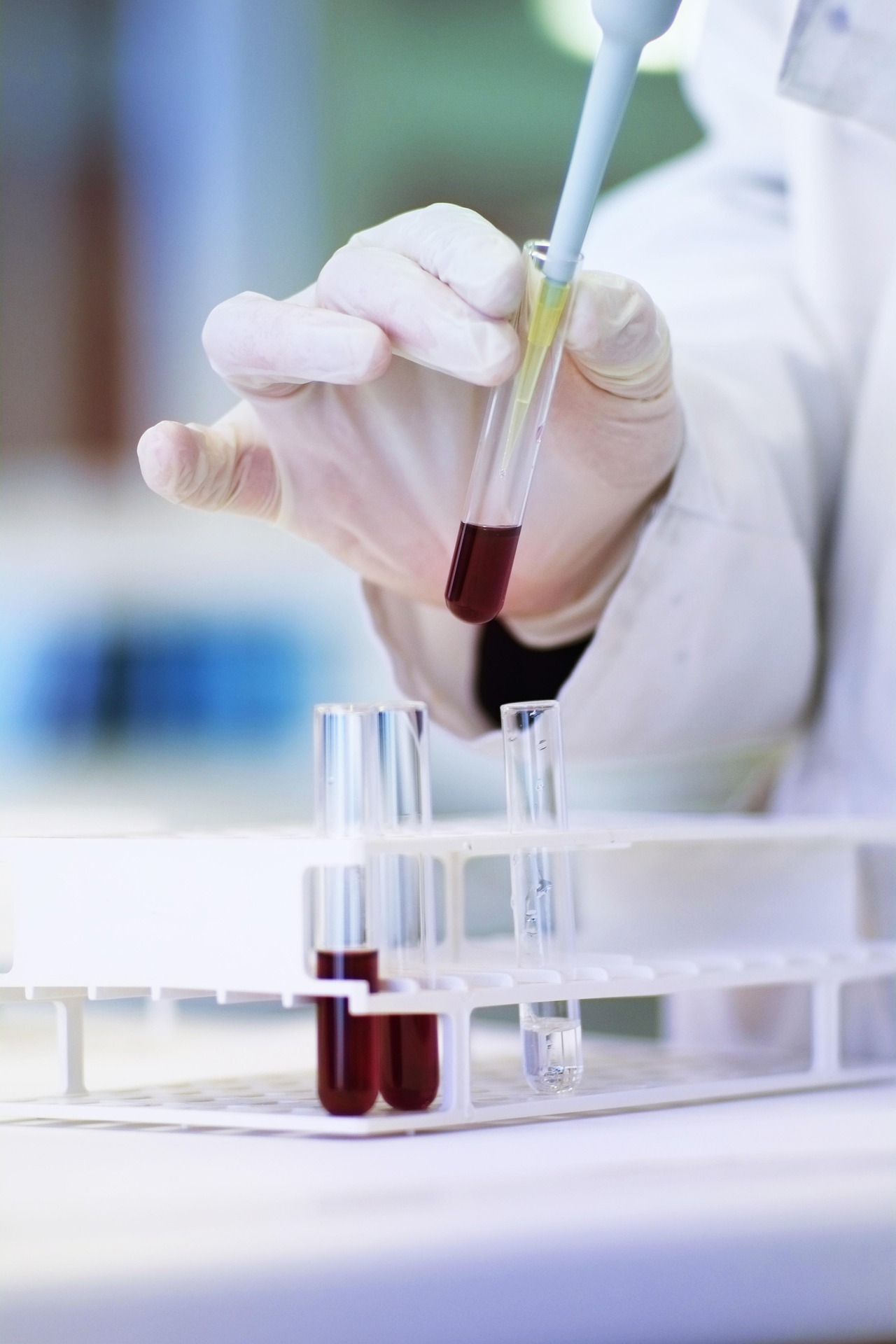 Engineered Immunotherapy Improves Brain Cancer Outcomes