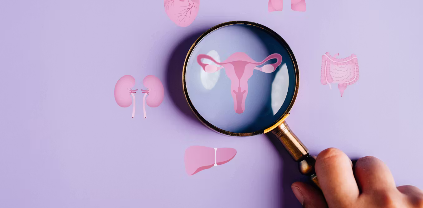 I’m a doctor who helped rename PCOS to PMOS – a 10‑year process of listening to 14,000 patients and health professionals speak on how to improve care