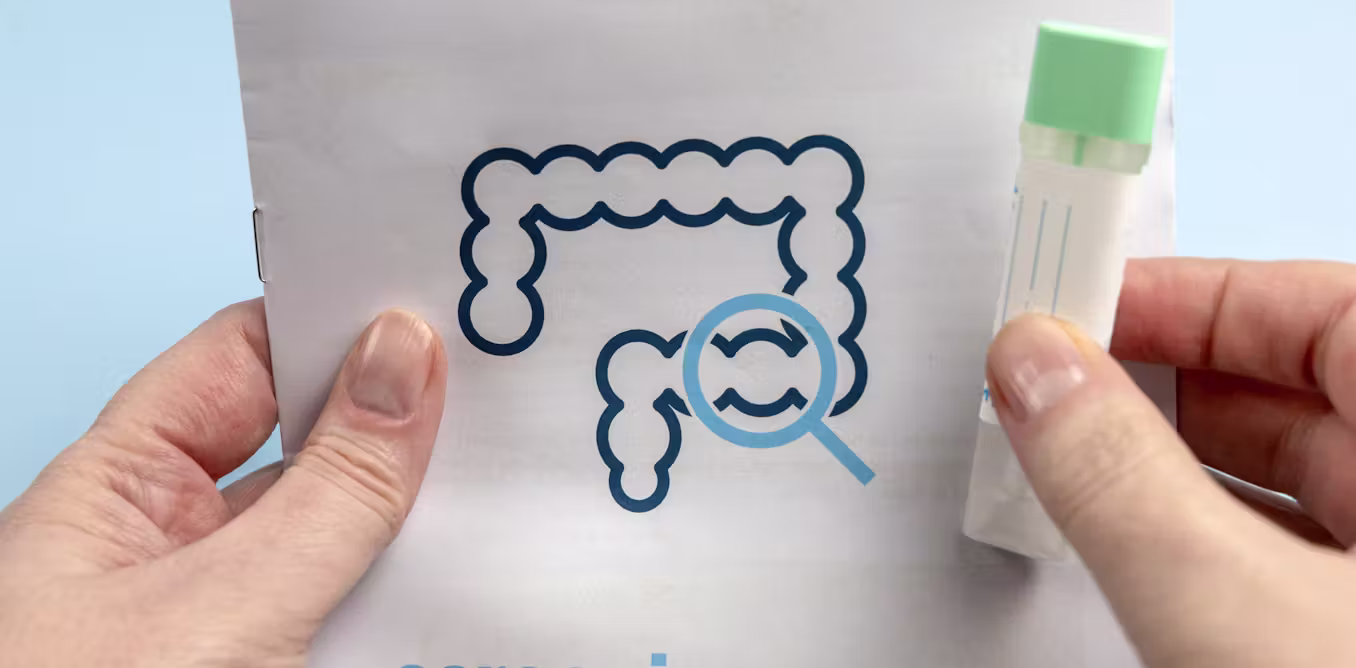 Poop tests and blood tests join colonoscopy as options for colorectal cancer screening