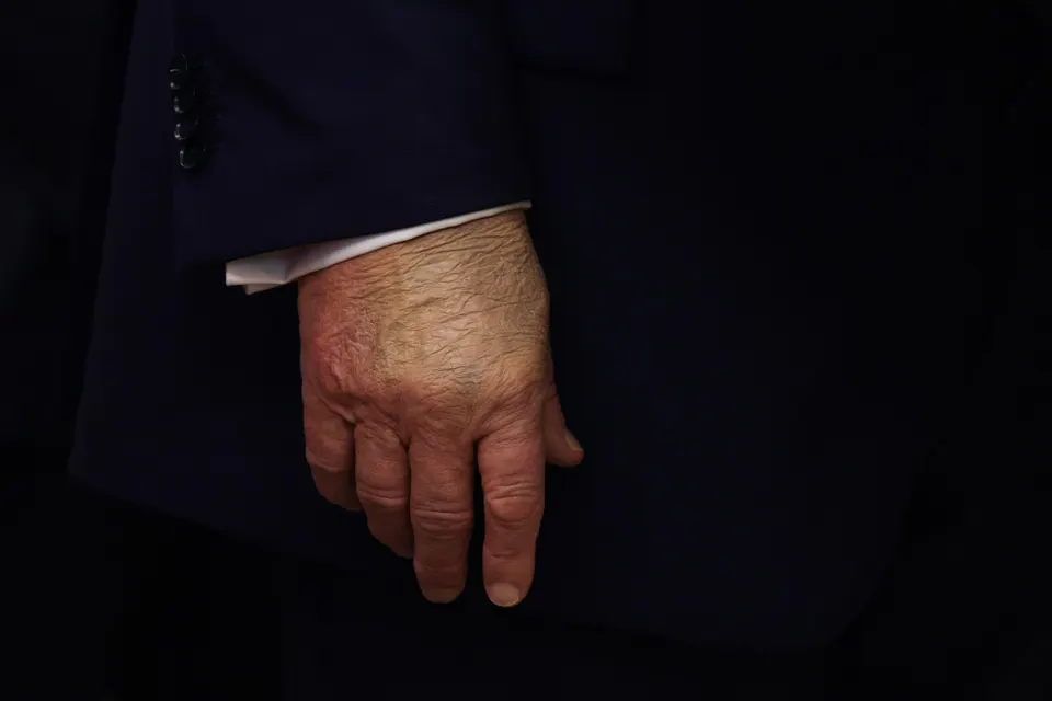 Lingering Questions After President Trump’s Physical And Health Checkup