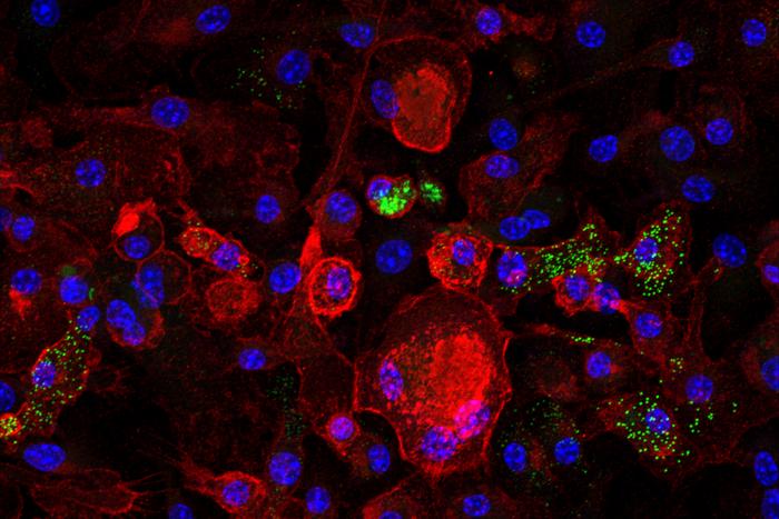 How Zombie Immune Cells Drive Fatty Liver Disease